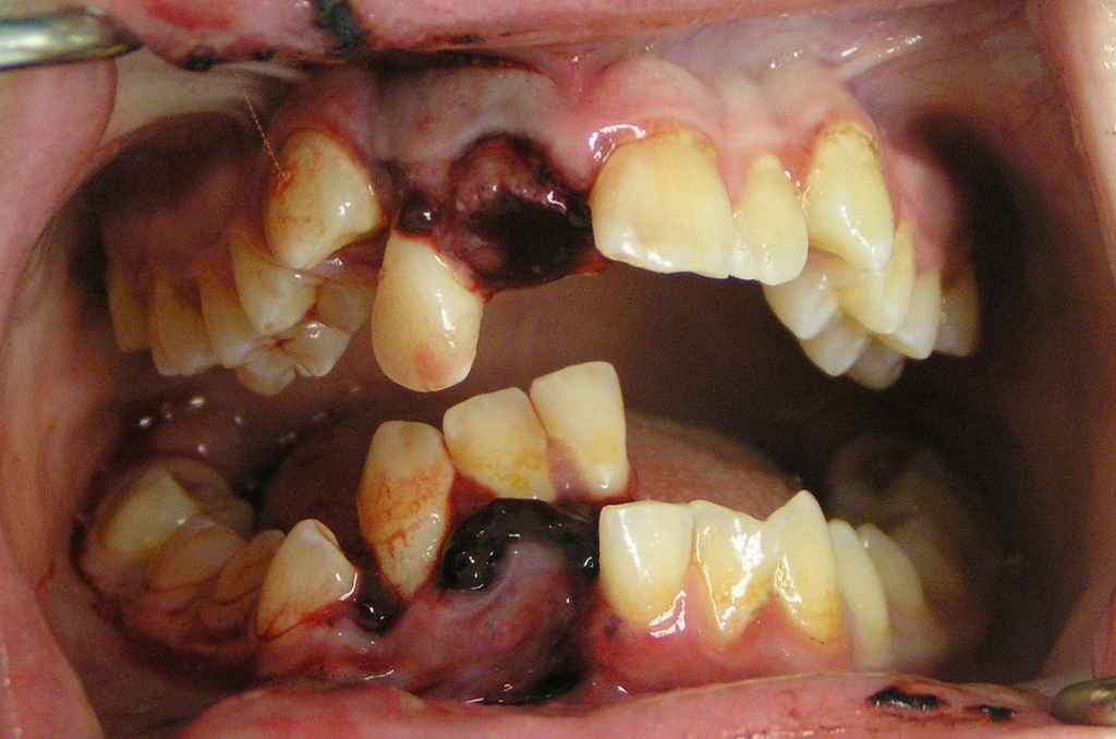 Dental Emergencies & Trauma3
